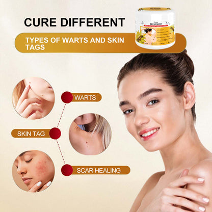🍀🐝[👑Official Brand Store👑] Cvreoz™ Bee Venom Mole and Wart Treatment Cream(👨‍⚕AAD RECOMMENDS)