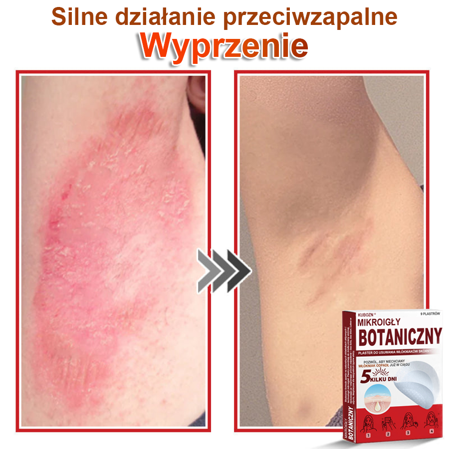 KUBOZN® – 🌿 Mikroigłowy Botaniczny Plaster 🌿 Skuteczne Usuwanie Narośli Skórnych | 💎 Naturalna Formuła