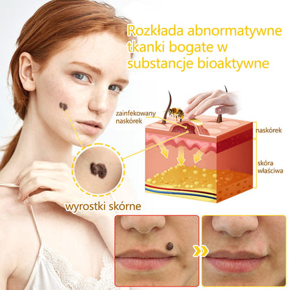 ✅flysmus™ Krem Leczniczy z Jadem Pszczelim🐝: Leczenie egzemy, łuszczycy, trądziku, trądziku różowatego, infekcji grzybiczych, brodawek
