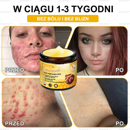 💐🌟💐Wyprodukowano i wysłano z Polski✨ Krem naprawczy do skóry VLSVLS® z jadem pszczelim🔥 Ostatni dzień zniżki 80%