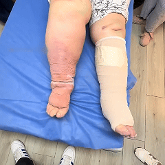 [ Efekty już w 7 dni ]👨‍⚕️ Croaie® Krem na Obrzęki i Żylaki (Certyfikat GMP UE • Opracowany na obrzęki, żylaki i słabe krążenie krwi 🦵)